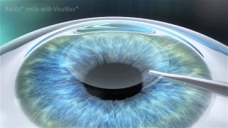test oftalmologico venezia Buoso Dr. Fabio